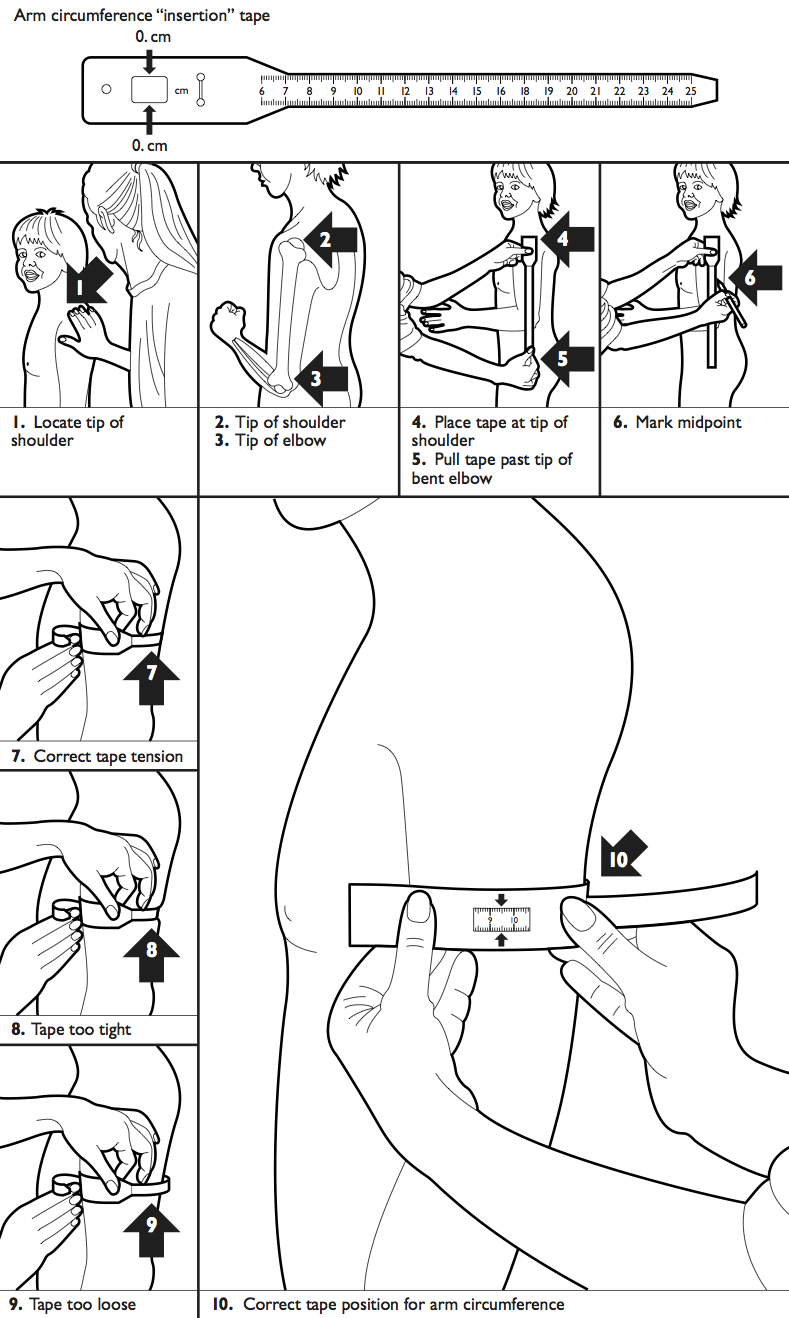 Steps in measuring MUAC